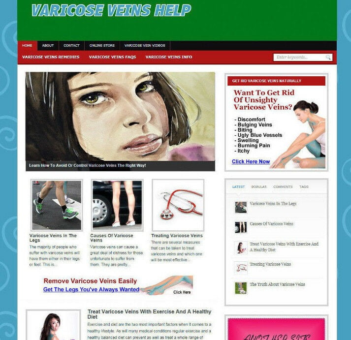 VARICOSE VEINS ADVICE AFFILIATE STORE WEBSITE - FREE DOMAIN - PRO DESIGN